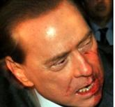 Silvio Berlusconi após ser agredido neste último domingo