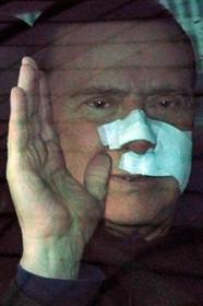 O premier italiano Silvio Berlusconi deixa o hospital San Raffaele com curativos no rosto