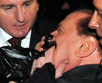 Berlusconi após ser agredido