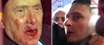 Berlusconi é atingido no rosto e levado para hospital