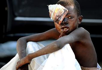 Criança ferida após o terremoto