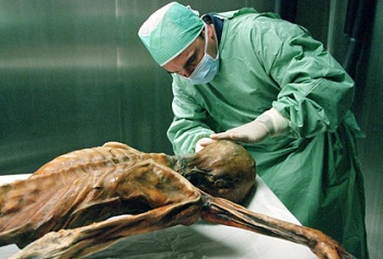 Cientista examina restos mortais de Ôtzi