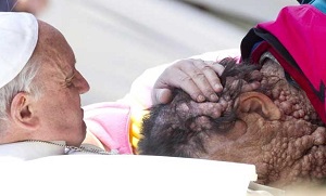 Papa Francisco consola enfermo